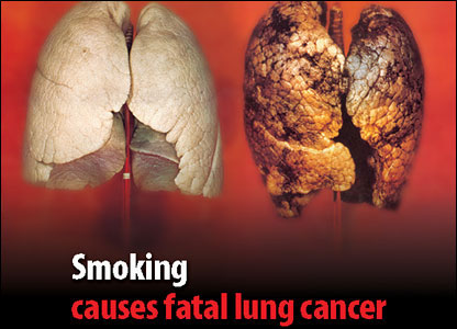 smoking kills more. Kills#39; and #39;Smoking